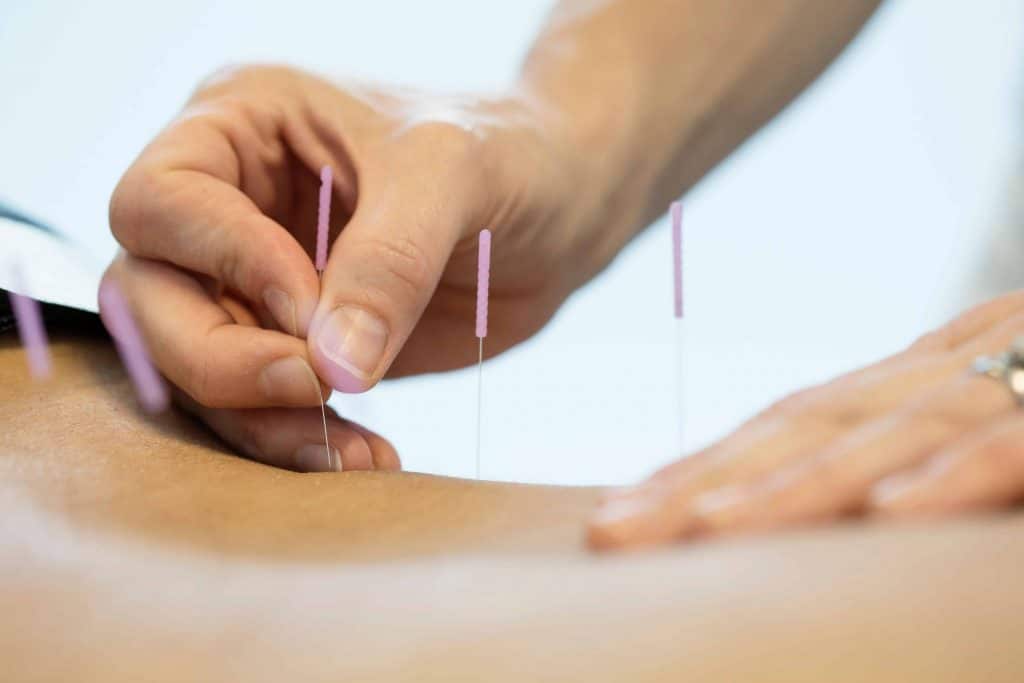 Akupunktur Majorstuen